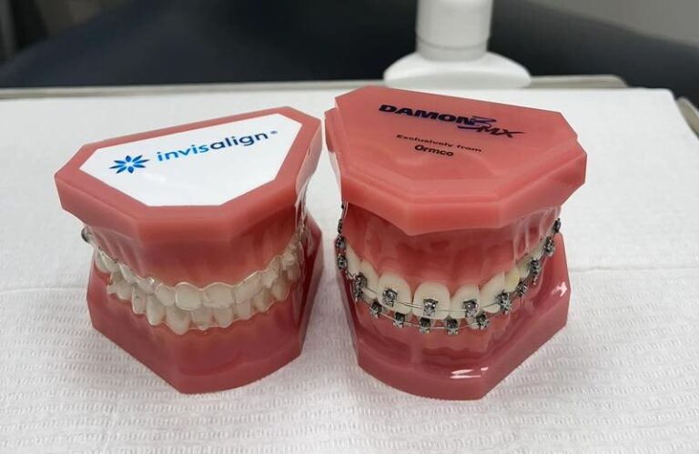 Alternatywy dla wosku ortodontycznego – czym zastąpić go w codziennej pielęgnacji?